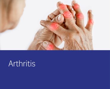 Arthritis - healthsave