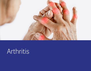 Arthritis - healthsave