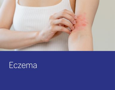 Eczema - healthsave